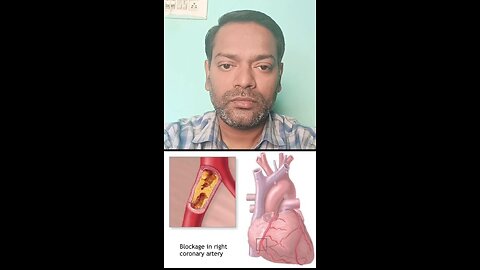 हार्ट के ब्लॉकेज को कम करने वाले प्राकृतिक खाने ।