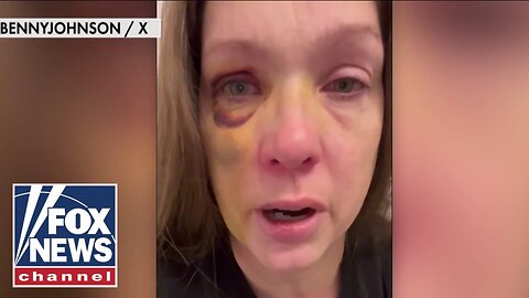 Cincinnati beating victim speaks out after brutal attack