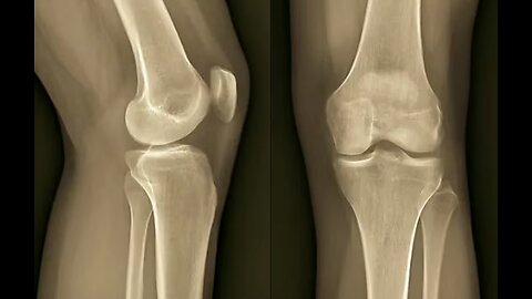 '5-Second Joint- Restoring Trick' Anyone Can Do at Home