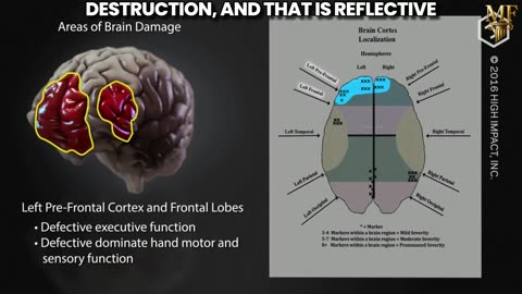 COVID mRNA Shots Linked to Behavioural Changes and Brain Damage (See Description Box)
