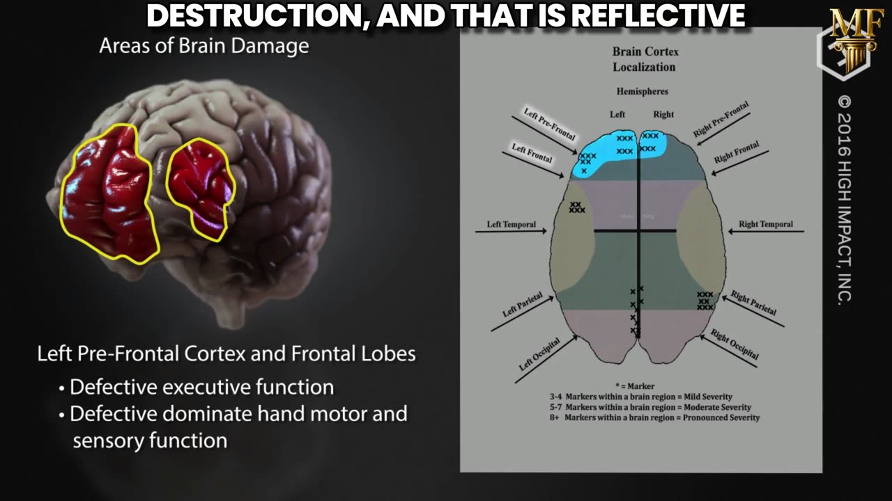 COVID mRNA Shots Linked to Behavioural Changes and Brain Damage (See Description Box)