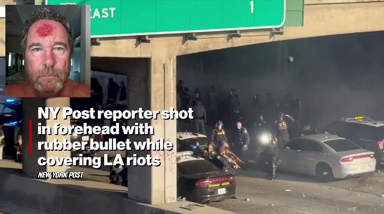 The LAPD sh**ts a New York Post photographer in the head with a rubber bullet during anti-ICE riots.