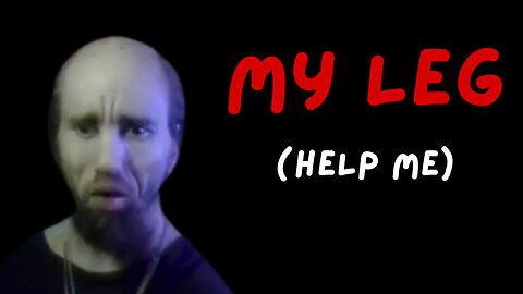 Steve can't Stream - Cyraxx begs for help cuz his leg hurts again (09/06/2025)