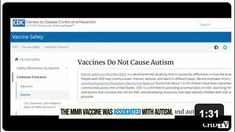 CDC's Dr. William Thompson openly admitted that the CDC had lied and covered up the fact that the MMR vaccine was associated with autism