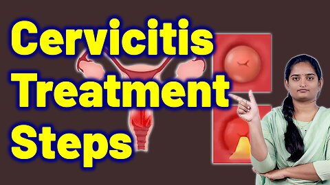 Cervicitis Treatment Steps | Cervical Mucositis, Endocervicitis, Infected Cervix.Homeopathy Medicine