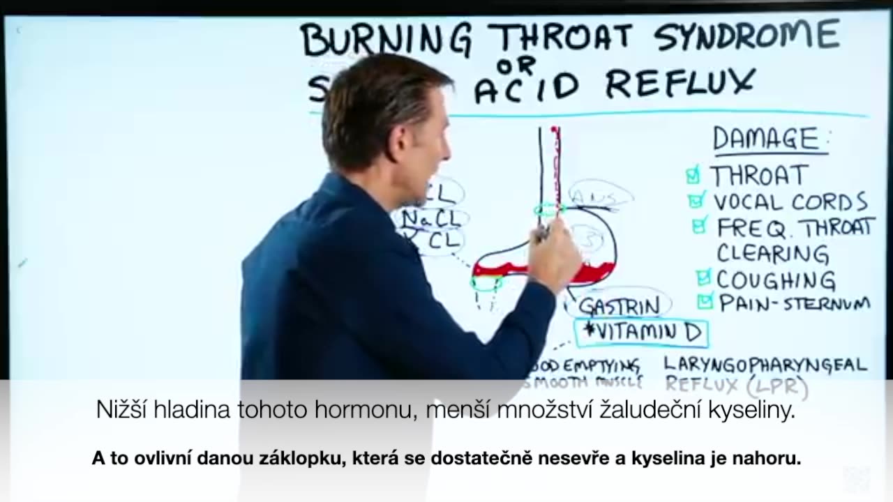 Reflux jícnu I Gastroezofageální reflux (GERD)