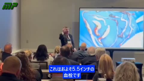 COVIDワクチン接種後の凝固塊： 米国州葬儀ディレクター協会