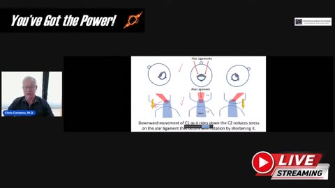 Chiropractic neck manipulations can cause CranioCervical Instability CCI