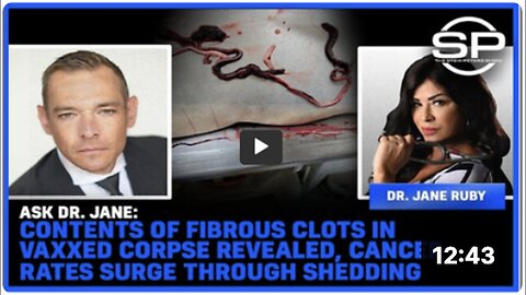 "Fibrous Clot Contents in Vaccinated Corpse Unveiled; Shedding Linked to Cancer Rate Increase"