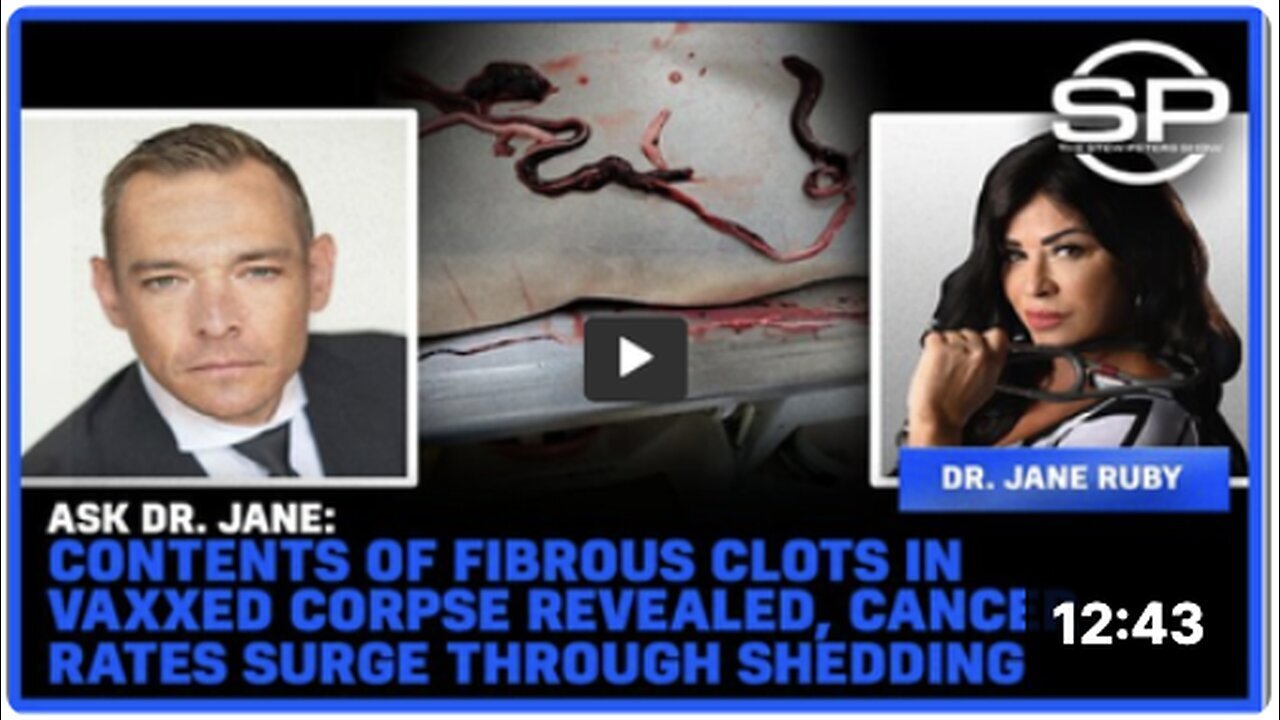 "Fibrous Clot Contents in Vaccinated Corpse Unveiled; Shedding Linked to Cancer Rate Increase"