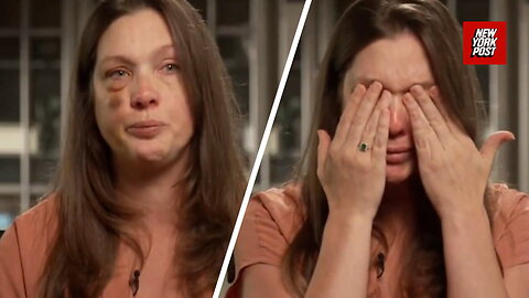 Single mom viciously beaten in Cincinnati brawl breaks down: 'I am not okay'