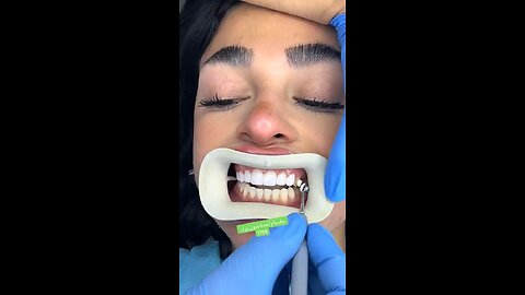 Tooth fix
