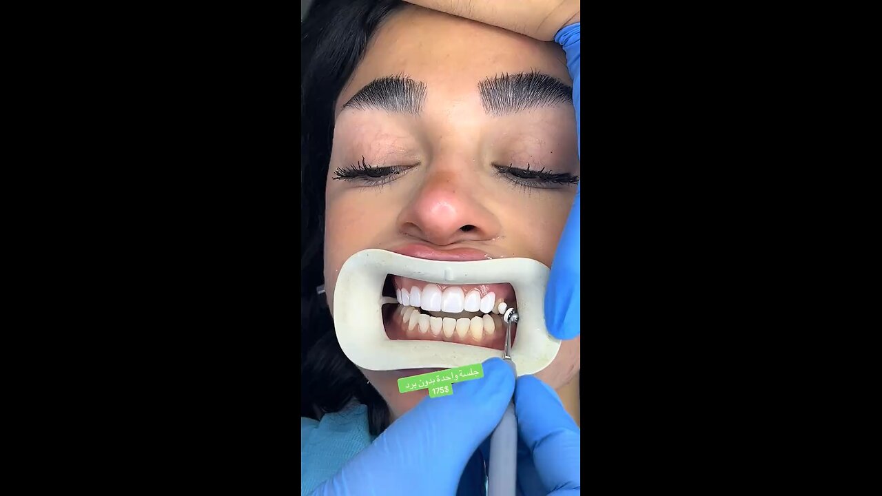 Tooth fix