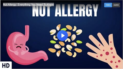 Nut Allergy: Everything You Need To Know