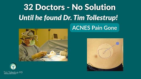 After 32 Doctors, ACNES Surgery Finally Ended Jeff’s Pain | Dr. Tim Tollestrup