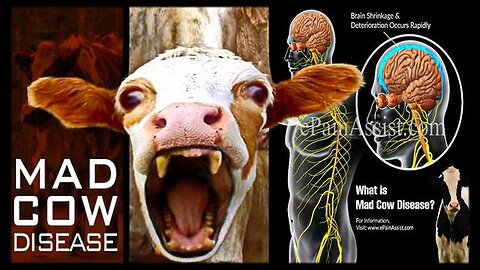 "Latest Updates on 'Turbo' CJD: Human Mad Cow Disease and Vaccine Bioweapon Controversies"