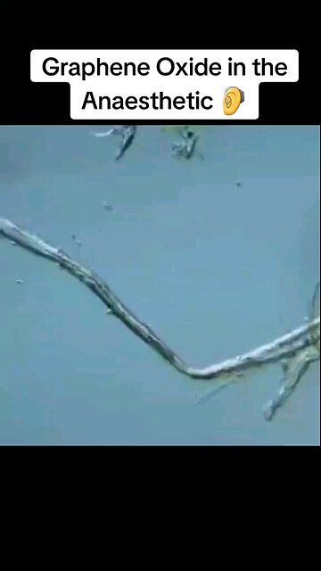 Graphene Oxide Discovered In Dental Anisthetic