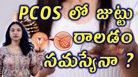 PCOS లో జుట్టు రాలడం సమస్యేనా? What is Hair fall in PCOS Homeopathy Treatment Cure Clinic Medicine