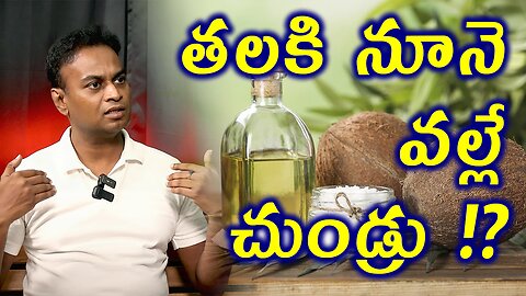 తలకి నూనె వల్లే చుండ్రు !? Does Applying Oil Causes Dandruff Homeopathy Treatment Medicine Cure