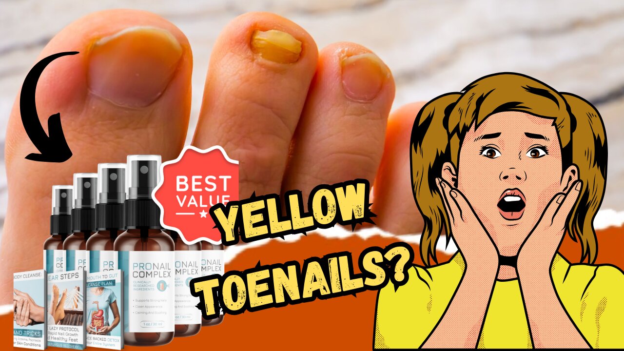 PRONAIL COMPLEX REVIEW - ((WATCH THIS)) - Pronail Complex Drops - Pronail Complex Reviews