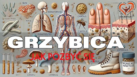 Grzybica - jak pozbyć się ? Najlepsze rozwiązania metoda. Aleksander Haretski.