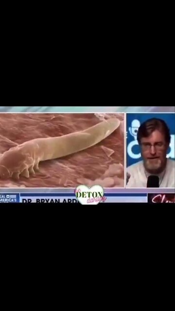 There Are 3 Herbs That Cure All 4 Major Parasitic Infections