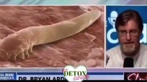 There Are 3 Herbs That Cure All 4 Major Parasitic Infections