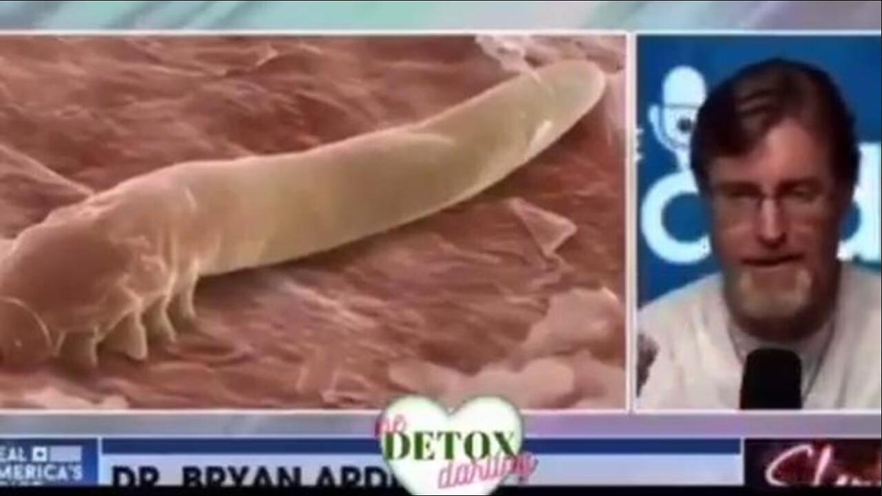 There Are 3 Herbs That Cure All 4 Major Parasitic Infections