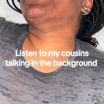 ✨ Chin Waxing with Sexy Smooth Golden Allure Hard Wax | @thee_princesstreatment ✨