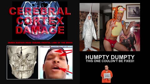 The Truth About Boss’s Learning Disability – Exposing Why He Lies & Lives in a Fantasy World!