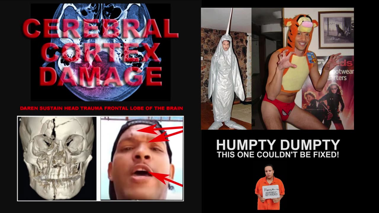 The Truth About Boss’s Learning Disability – Exposing Why He Lies & Lives in a Fantasy World!