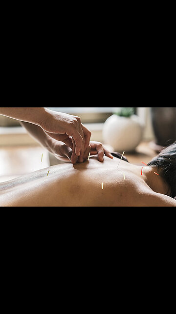 Acupuncture Thornhill: Awakens Inner Healing Energy at Midori Day Spa