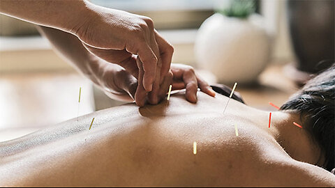 Acupuncture Thornhill: Awakens Inner Healing Energy at Midori Day Spa