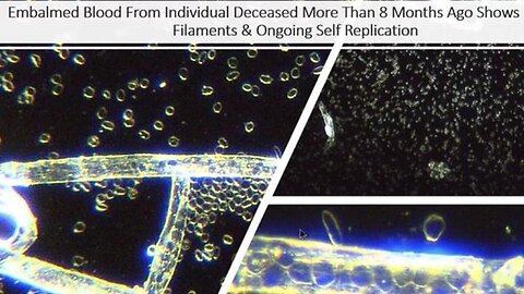 "Ex-Vaccine Advocate Warns Indians About Dire Consequences: Reveals All"