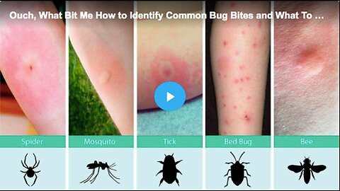 "Identifying Common Bug Bites and Effective Remedies"