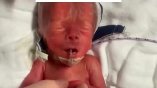 Every child is worthy of life