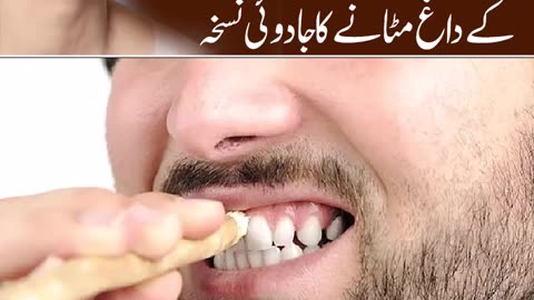 HomebRemedy For Teeth Whitening