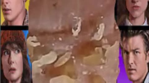 blackhead
