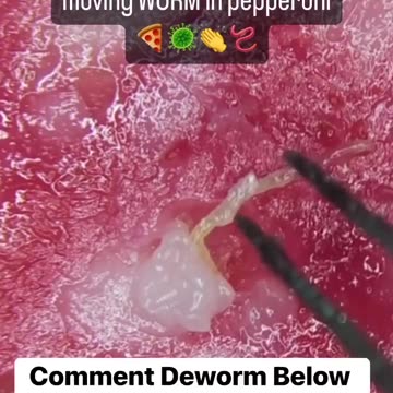 Pepperoni pizza lovers and parasite cleansing