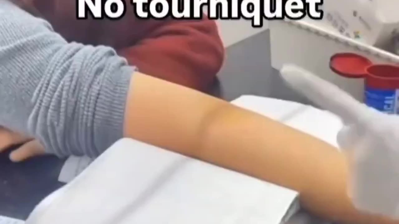 Chinese nurse uses this technique called "flying needle" to draw blood.