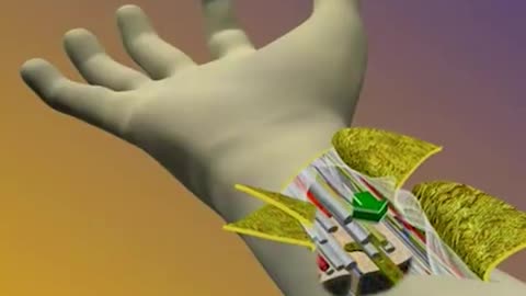 Human Hand Transplant Procedure 3D Animation
