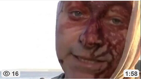 Bondi Shooting, a False Flag Operation? ~ Dimitri Legrand