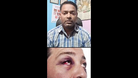 आंख की चोट का इलाज ।