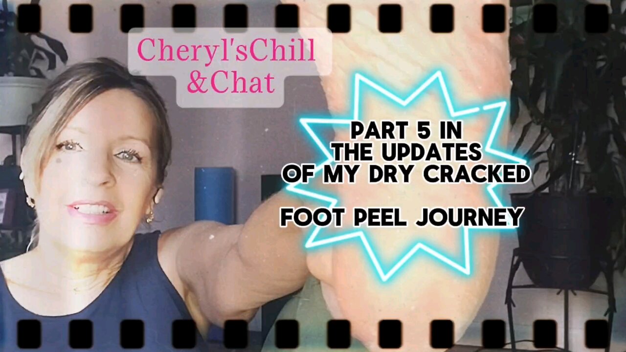 UPDATE on the process of a Dry Cracked foot peel