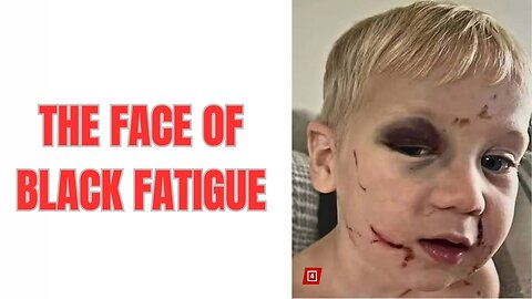 LUKE GOES POSTAL! (Black Fatigue Alpha, Woman Assaults 3 Year Old at Daycare)