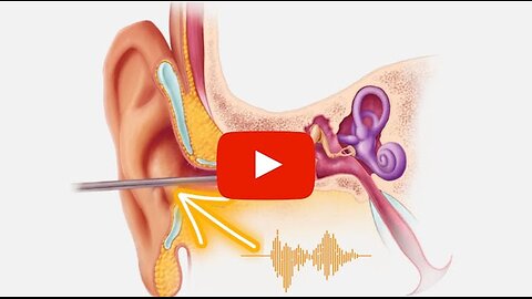 Top Neuroscientists : This DIY Method Mutes Ear Ringing And Sharpens Memory