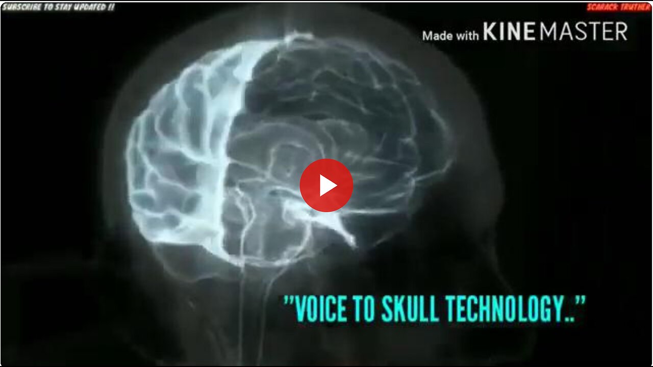 HIDDEN SECRETS of 5G Finally REVEALED! | Scarack Truther