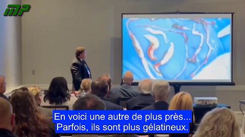 Caillots après avoir reçu le vaccin COVID