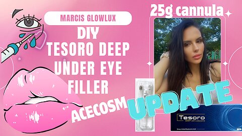 UPDATE UNDER EYE FILLER UPDATE