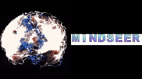 #MINDSEER #08/09/25 #VANGUARD